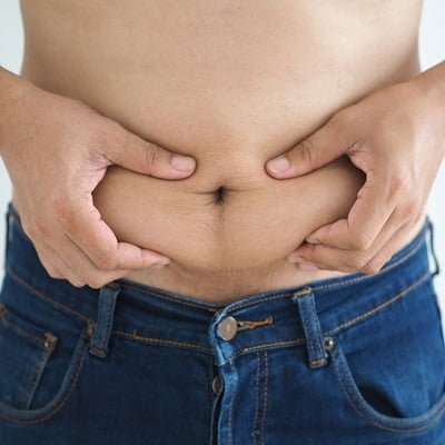 Abdominoplasty in Islamabad, Rawalpindi, and Pakistan